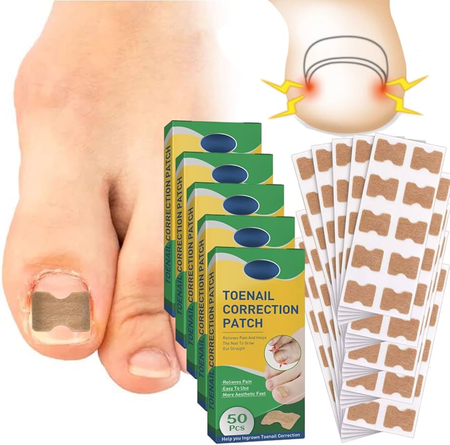 PEDICARE® - Parches Correctores de Uñas Encarnadas - ¡DILE ADIÓS AL DOLOR!